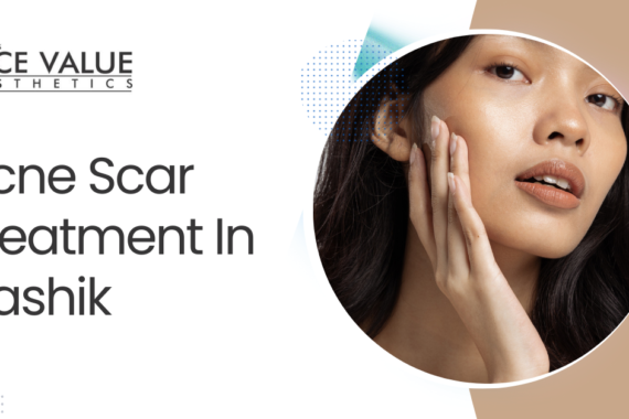 Acne Scar Treatment In Nashik