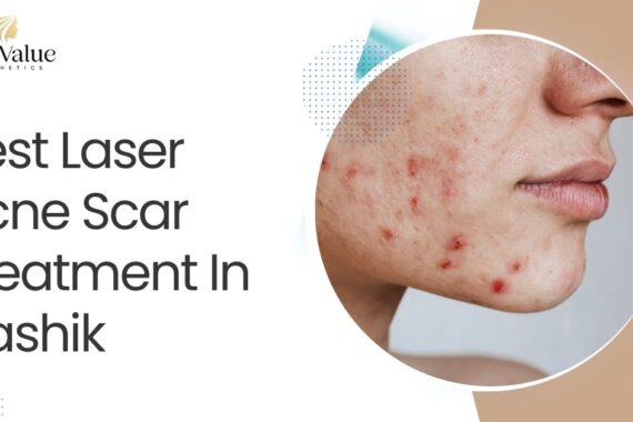 Best Laser Acne Scar Treatment In Nashik