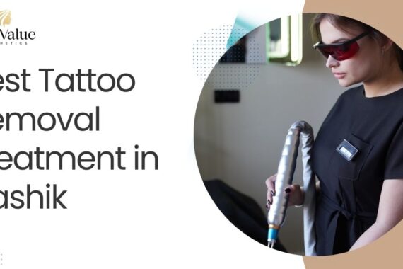 Best Tattoo Removal Treatment in Nashik