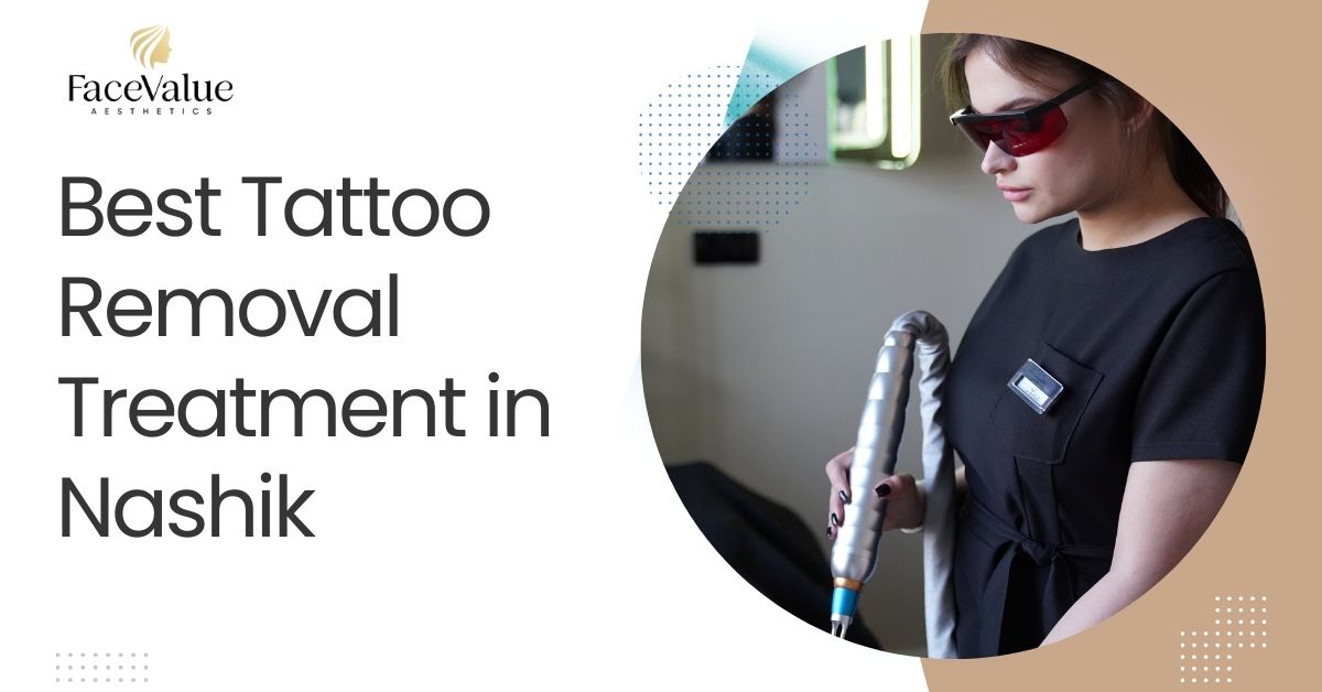 Best Tattoo Removal Treatment in Nashik